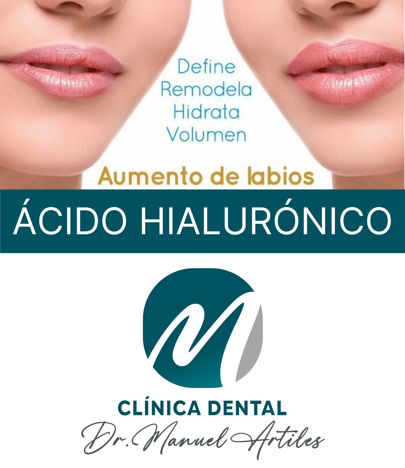 Aumento de labios con ácido hialurónico en clínica dental Dr. Manuel Artiles